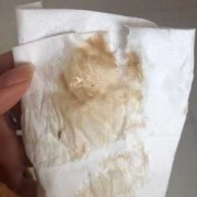 孕期有白带吗,怀孕的最初征兆1-14天