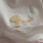 孕期流黄水（孕期流黄水）