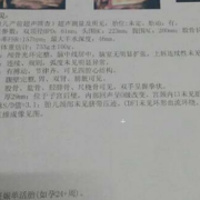36周胎儿b超数据标准（36周胎儿b超数据标准对照表）