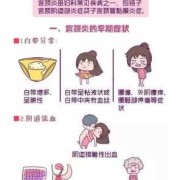孕期有宫颈炎（宫颈炎的表现症状，能自己调理吗）
