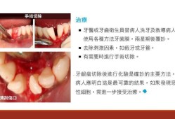 孕期牙龈瘤（牙龈瘤的治疗方法是什么）