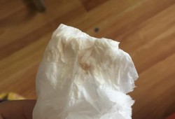 孕期小便有血（孕期小便有血）