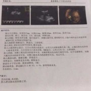 24周胎儿有多大,24周胎儿四维彩超数据标准值