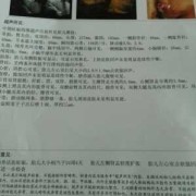 胎儿双肾肾窦分离是否严重,胎儿肾窦分离是什么意思