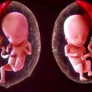 孕妇29周胎儿是多少重？怎样计算怀孕29周的胎儿有多重呢,怀孕29周胎儿图片真人