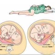 怀孕肚子歪右边怎么回事，怀孕肚子歪右边注意事项,孕期子宫右旋是什么意思