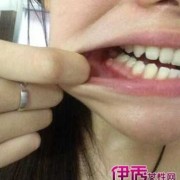 怀孕期间牙龈肿痛发炎怎么办（孕妇牙龈肿痛会自愈吗）