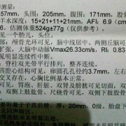 羊水最大暗区深度多少正常？怀孕二十五周，担心对宝宝发育不好,25周胎儿发育标准数据表