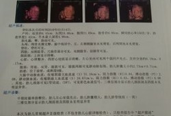 四维彩超心脏有强光点怎么办,24周胎儿左心室强光点怎么办