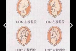 胎位右枕前是什么意思呢,胎儿右枕前位图片示意图