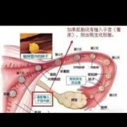 胎儿生化是什么症状（生化妊娠为什么会腹痛的啊？还是很想知道的）