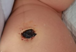 宝宝脐带有点红，搓肚子时发现出血了，怎么办?急急急,胎儿玩脐带妈妈会痛吗