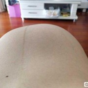 胎动鼓包是胎儿在干嘛的表现来着的呢,胎儿鼓包是哪个部位图片
