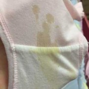 孕期流黄水（孕期流黄水）