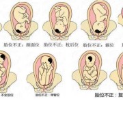 LOA是男孩还是女孩,胎儿头位loa图片