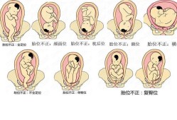LOA是男孩还是女孩,胎儿头位loa图片
