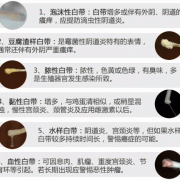怀孕白带异常怎么办,