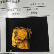 五个月胎儿的彩超图（五个月胎儿的彩超图片）