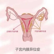 孕期积液增多（水量大的原因是什么）