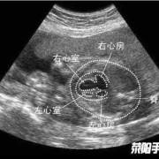 胎儿心脏畸形（造成胎儿心脏畸形的原因是什么）