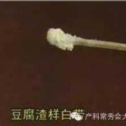 怀孕期分泌物多怎么办（孕妇白带多正常吗）