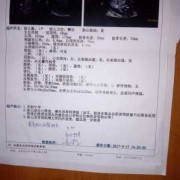 胎儿双肾偏大（胎儿双肾偏大）