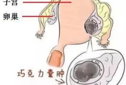 孕期囊肿增大（孕期囊肿增大肚子是不是也特别显怀?）