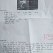 胎儿颅骨光环（颅骨光环是什么意思）