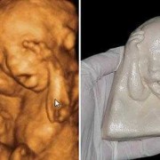 怀孕3个月胎儿大小（怀孕3个月胎儿大小和哪种水果一样）