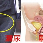 胎儿会尿尿吗（生孩子后会漏尿吗?）