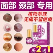 猴子怀胎多久,孕期长瘊子是怎么回事