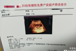11周+孕期检查NT值3.4，是不是说明胎儿不正常,胎儿十一周的样子图片