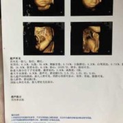 产检胎儿偏大（产检胎儿偏大一周正常吗）