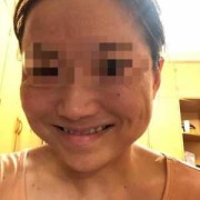 瘦脸针对胎儿有影响吗（瘦脸针对胎儿有影响吗?）