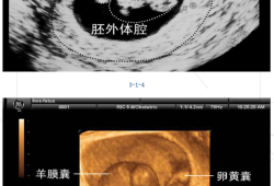 胎儿阴囊发育时间（胎儿阴囊发育时间表）