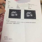 有没有孕期一直出血的（怀孕8周多每天都有出一点点的血，去医院检查胎心胎芽都正常）