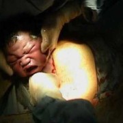 生孩子的真实过程，女人生孩子有多痛苦,胎儿在子宫里的视频真实