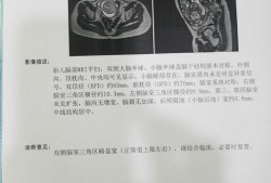 胎儿侧脑室增宽是什么原因导致的（胎儿侧脑室增宽是什么原因导致的怎么治疗）