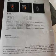 胎儿心脏彩超和四维彩超的区别（做四维彩超给宝宝查心脏吗）