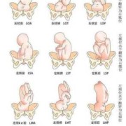左枕后位是什么意思,胎儿枕位是什么意思图片