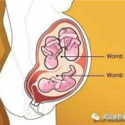 子宫双附件是什么,双子宫胎儿都比较小吗正常吗