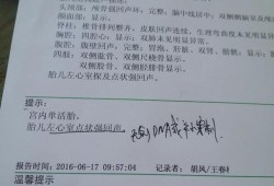 左心室强回声点是什么原因,胎儿左心室内强回声点是什么意思