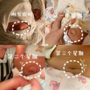 胎儿拱肚脐（胎儿拱肚脐眼怎么回事）