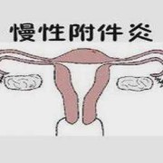 附件炎可以怀孕吗,孕期附件炎疼痛怎么办
