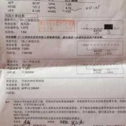 nt正常唐筛结果高风险是什么情况哪？担心胎儿会发育畸形了,担心胎儿畸形怎么办