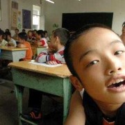怀孕脑瘫是怎么形成的,小孩脑瘫几个月能看出来