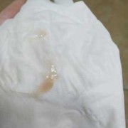 孕期见红怎么回事（梦见孕期见红怎么回事）