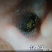 孕期手电照宝宝瞎（孕期手电照胎儿瞎）