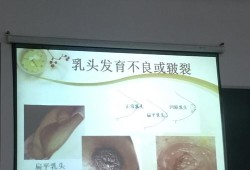 孕期乳头皲裂（孕期乳头皲裂图片和症状）