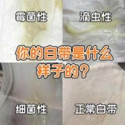 白带异常会影响受孕吗,